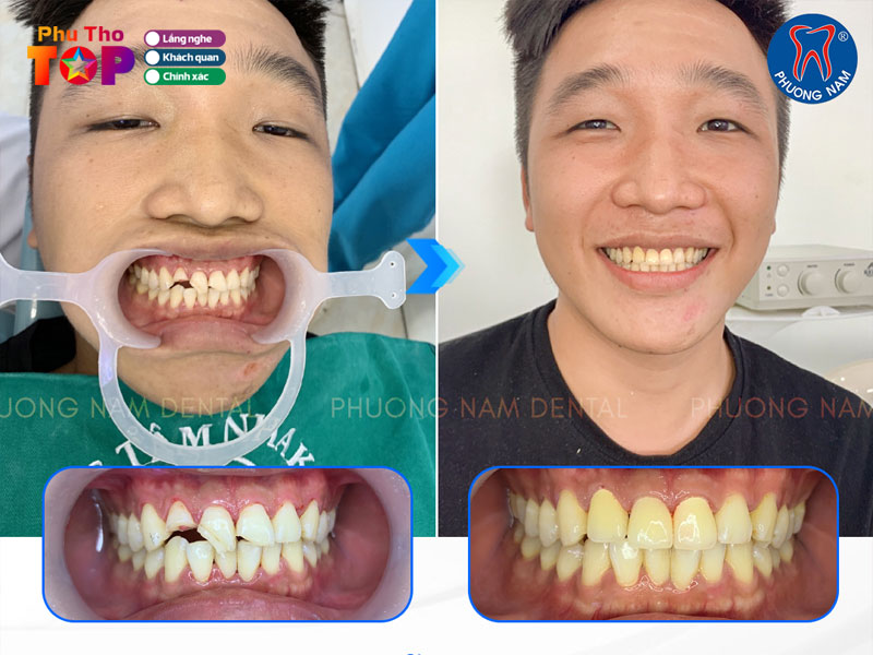 Nha-khoa-phuong-nam-phuthotoplist