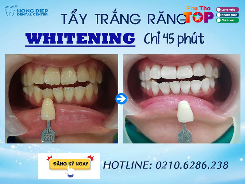 Nha-khoa-hong-diep-phuthotoplist