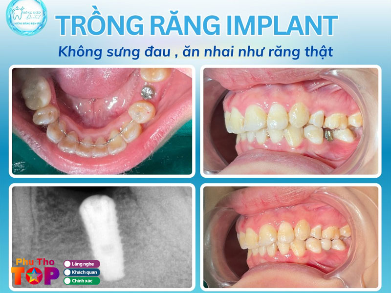 Nha-khoa-hong-diep-phuthotoplist