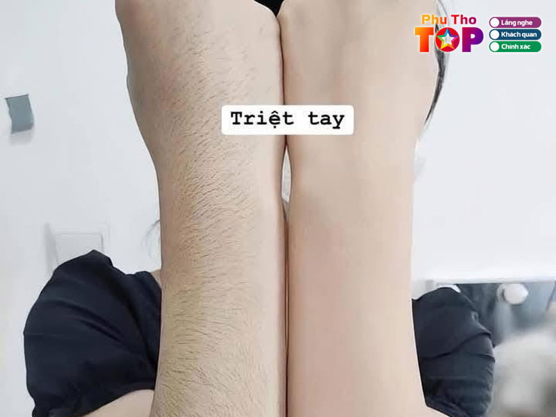 Nhu-quynh-spa-phuthotoplist