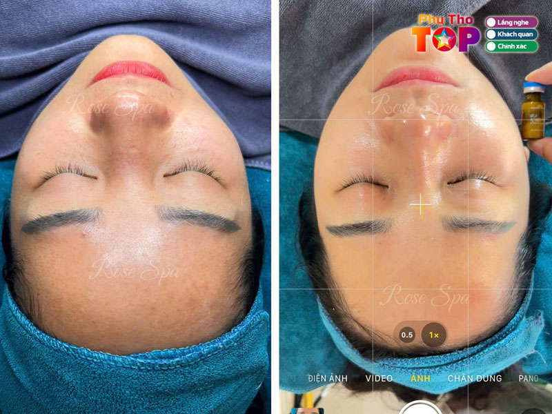 Rose-spa-phuthotoplist