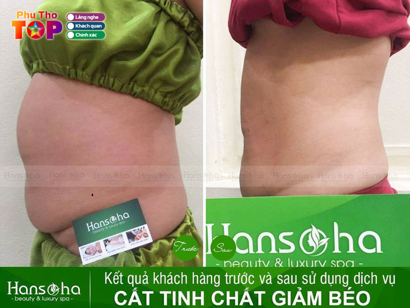 Vien-tham-my-hansoha-phuthotoplist