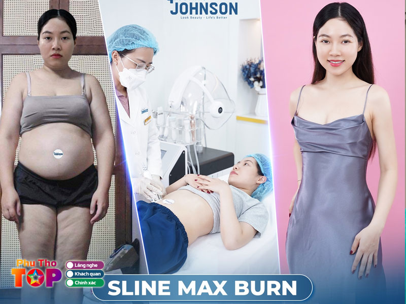 Vien-tham-my-johnson-clinic-phuthotoplist