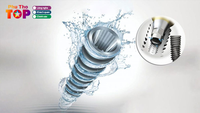 Tru-implant-han-quoc-lua-chon-can-bang-giua-chi-phi-va-hieu-qua-phuthotoplist