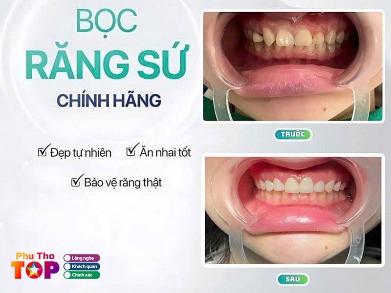 Nha-khoa-hong-diep-phuthotoplist