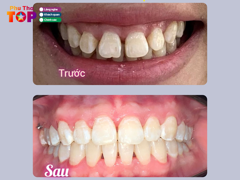 Nha-khoa-ngoc-anh-phuthotoplist