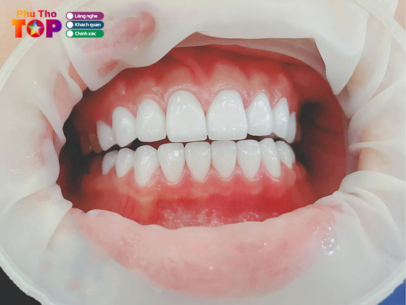 Nha-khoa-thang-long-phuthotoplist