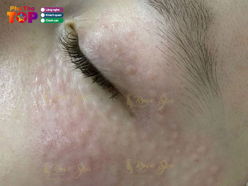 Rose-spa-phuthotoplist