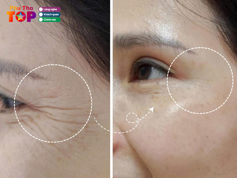 Yun-spa-phuthotoplist