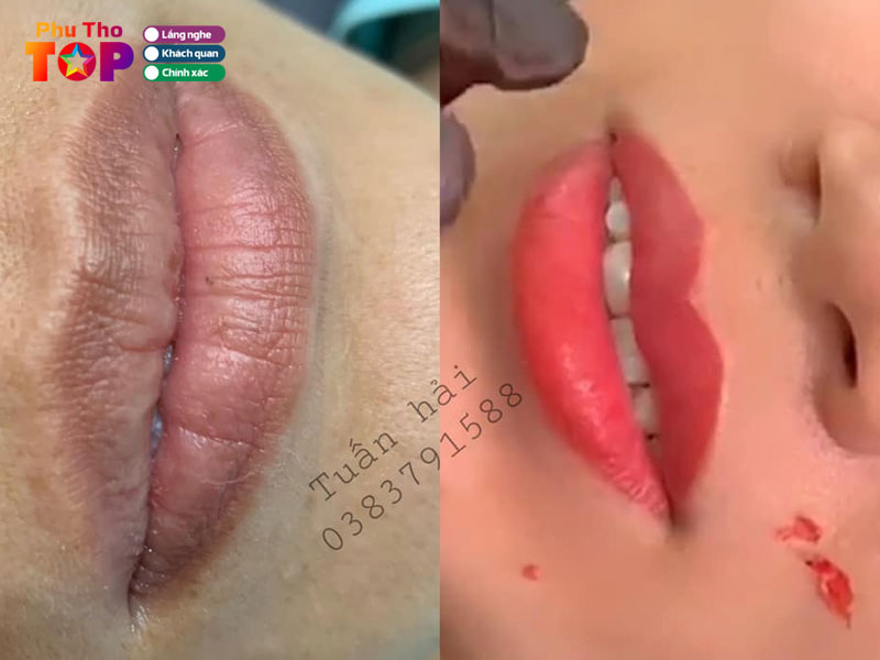 Phun-xam-tham-my-tuan-hai-phuthotoplist