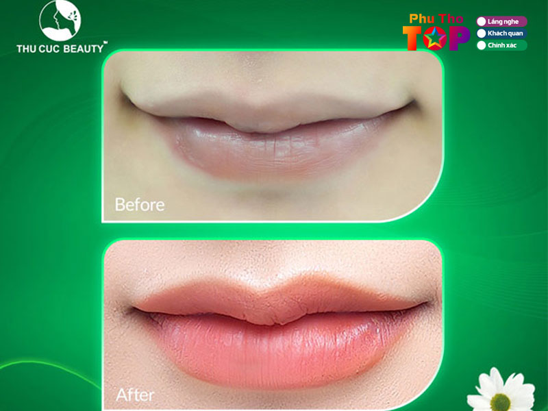 Thu-cuc-clinics-phuthotoplist