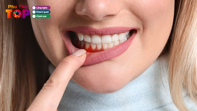 Top-10-dia-chi-dieu-tri-nha-chu-o-phu-tho-uy-tin-bac-si-gioi-phuthotoplist