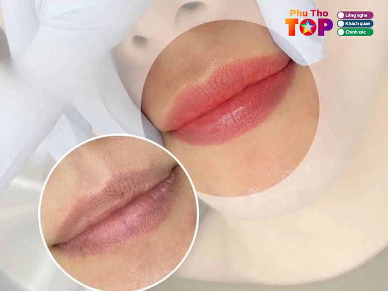 Tram-phun-xam-dep-phuthotoplist