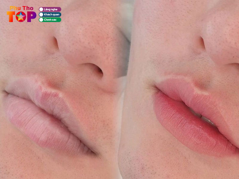 Vien-tham-my-hansoha-phuthotoplist