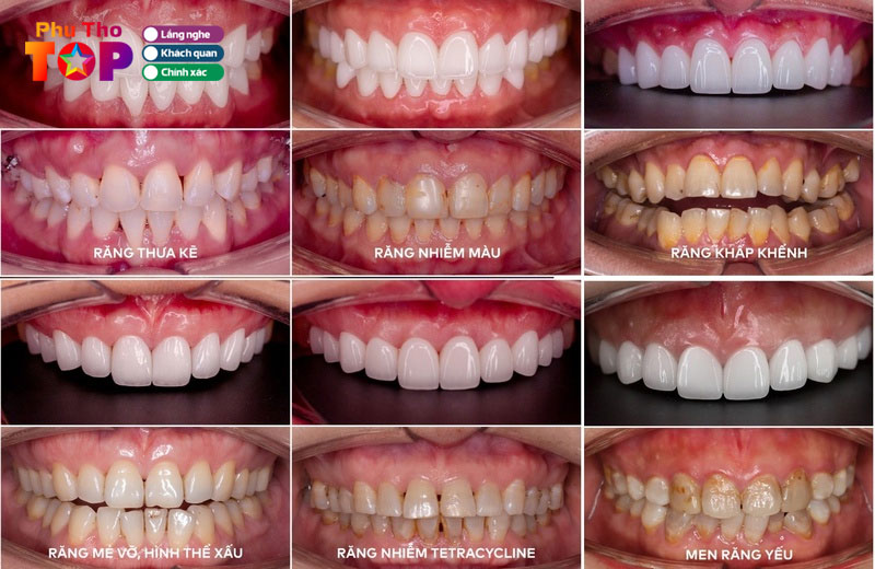 Cac-dich-vu-khang-dinh-uy-tin-cua-nha-khoa-dong-nam-phuthotoplist