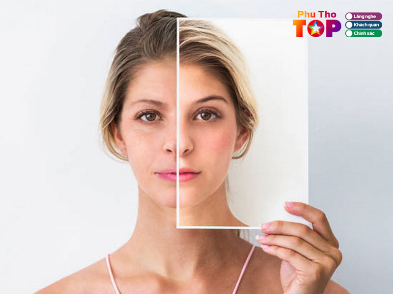 Mot-so-luu-y-de-khi-chon-dich-vu-tre-hoa-da-kem-uy-tin-phuthotoplist