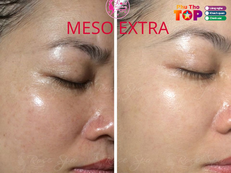 Rose-spa-phuthotoplist