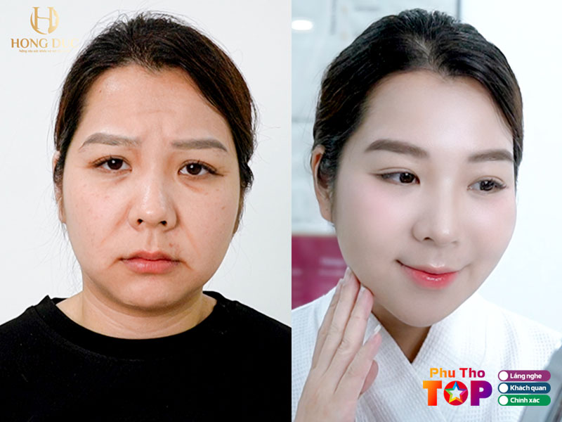 Tham-my-hong-duc-phuthotoplist