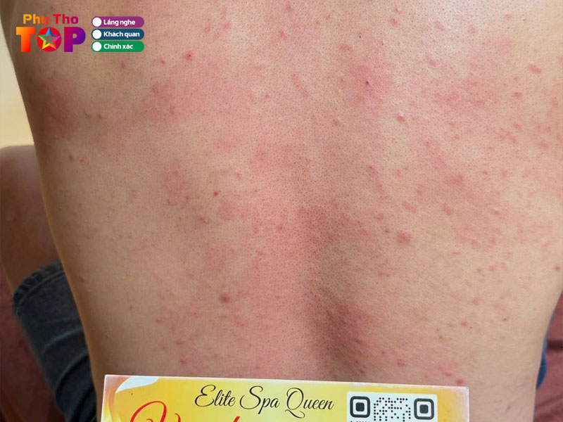 Elite-spa-phuthotoplist