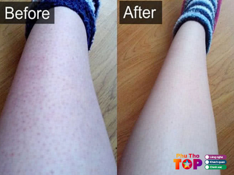 Hanna-spa-phuthotoplist