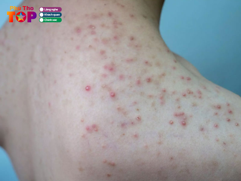 Huong-giang-spa-clinic-phuthotoplist