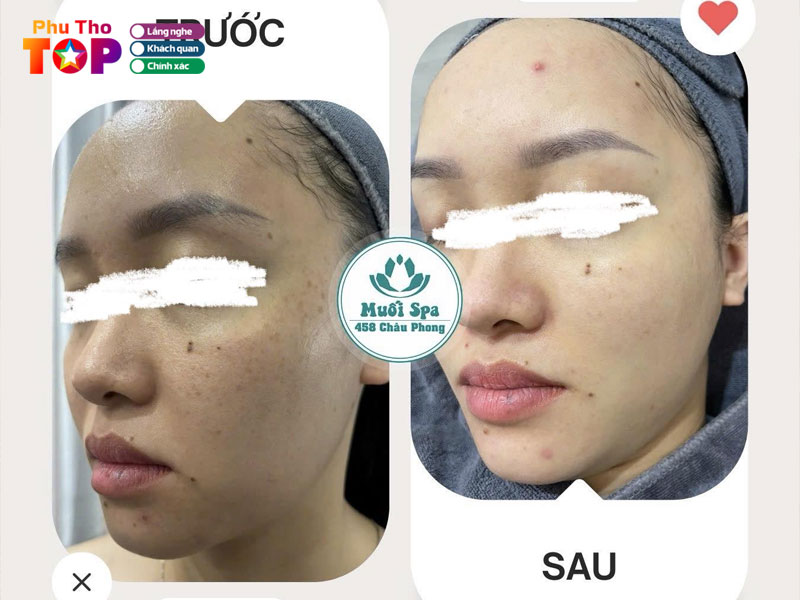 Muoi-spa-phuthotoplist