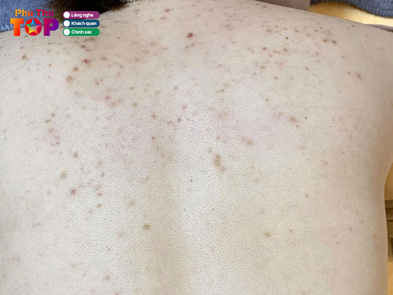 Phong-kham-da-lieu-viet-duc-phuthotoplist