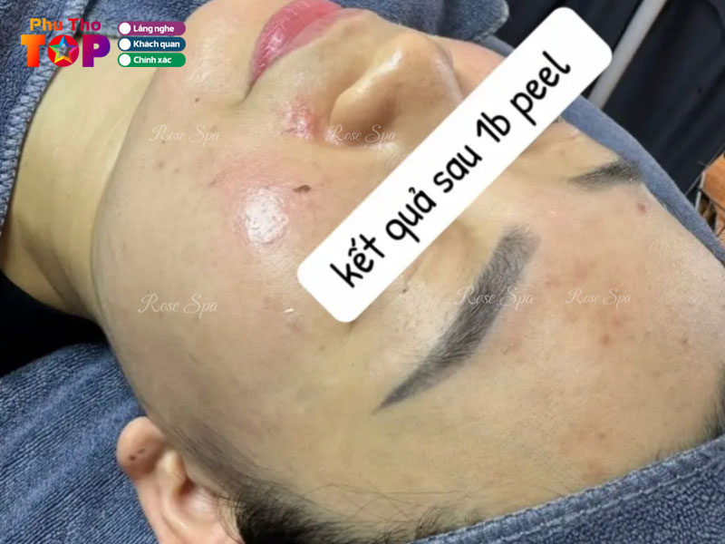 Rose-spa-phuthotoplist