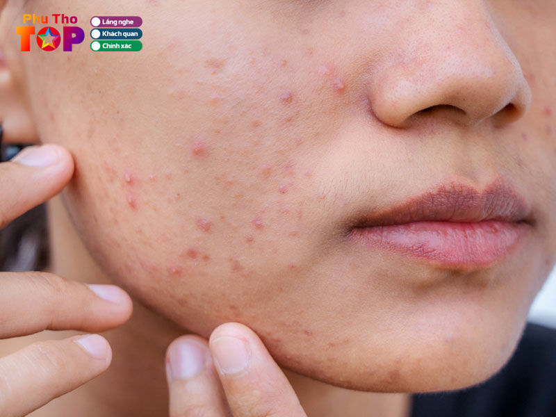 Spa-phuong-loan-phuthotoplist