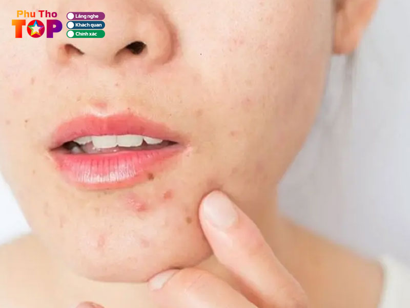 Tham-my-hong-ngoc-phuthotoplist