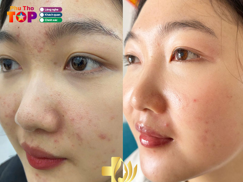 Thien-huong-clinic-spa-phuthotoplist