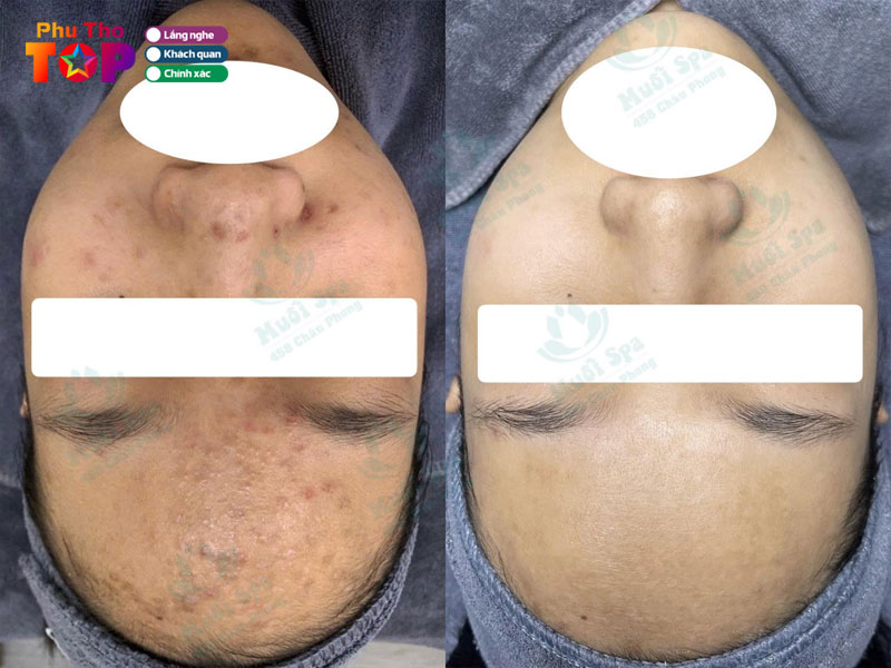 Muoi-spa-phuthotoplist