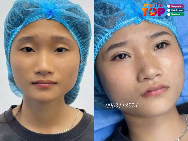 Hoang-yen-beauty-clinic-phuthotoplist